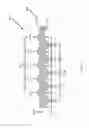 Fig. 19 - ASPIRATION AND MECHANICAL THROMBECTOMY METHODS