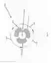 Fig. 20 - ASPIRATION AND MECHANICAL THROMBECTOMY METHODS