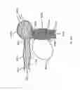 Fig. 209 - ASPIRATION AND MECHANICAL THROMBECTOMY METHODS