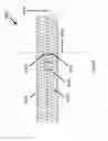 Fig. 25 - ASPIRATION AND MECHANICAL THROMBECTOMY METHODS