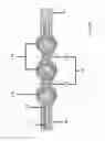 Fig. 90 - ASPIRATION AND MECHANICAL THROMBECTOMY METHODS