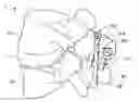 Fig. 01 - Apparatus for spinal fixation and methods of use