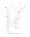 Fig. 02 - Periprosthetic bone plates