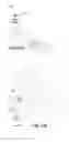 Fig. 08 - Anti-penetration bone implant device and method