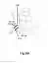 Fig. 28 - Anti-penetration bone implant device and method