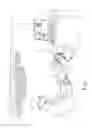 Fig. 02 - SUCTION DEVICE FOR USE IN IMAGE-GUIDED SINUS MEDICAL PROCEDURE