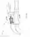 Fig. 08 - SUCTION DEVICE FOR USE IN IMAGE-GUIDED SINUS MEDICAL PROCEDURE