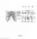 Fig. 04 - Model-based teeth reconstruction
