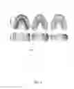 Fig. 05 - Model-based teeth reconstruction