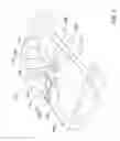 Fig. 09 - Methods, systems and accessories useful for procedures relating to dental implants