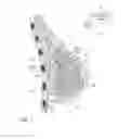 Fig. 02 - Detection of leakage in implants