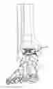Fig. 01 - TOTAL ANKLE REPLACEMENT JOINT