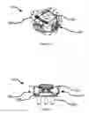 Fig. 02 - TOTAL ANKLE REPLACEMENT JOINT