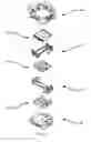 Fig. 05 - TOTAL ANKLE REPLACEMENT JOINT