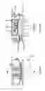 Fig. 07 - TOTAL ANKLE REPLACEMENT JOINT