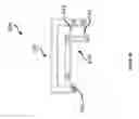 Fig. 14 - TOTAL ANKLE REPLACEMENT JOINT