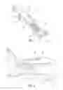 Fig. 02 - Laminoplasty implant, method and instrumentation