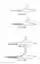 Fig. 26 - Stent alignment during treatment of a bifurcation