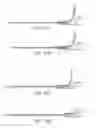 Fig. 27 - Stent alignment during treatment of a bifurcation
