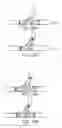Fig. 28 - Stent alignment during treatment of a bifurcation