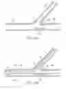 Fig. 33 - Stent alignment during treatment of a bifurcation
