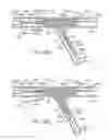 Fig. 43 - Stent alignment during treatment of a bifurcation