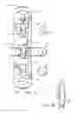 Fig. 02 - Tightening system for orthotics