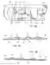 Fig. 04 - Tightening system for orthotics