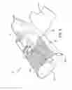 Fig. 06 - Neonatal drape device