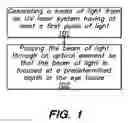 Fig. 02 - Method and system for modifying eye tissue and intraocular lenses