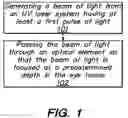 Fig. 02 - Method and system for modifying eye tissue and intraocular lenses