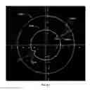 Fig. 02 - LASER METHODS AND SYSTEMS FOR THE ALIGNED INSERTION OF DEVICES INTO A STRUCTURE OF THE EYE