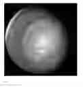 Fig. 49 - Systems and Methods for Laser Eye Surgery