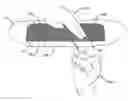 Fig. 01 - Methods and devices for skin closure