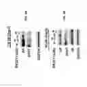 Fig. 07 - Methods for treating cancer with RORγ inhibitors