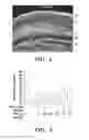 Fig. 03 - USE OF CHELATORS OF DIVALENT CATIONS TO PROMOTE NERVE REGENERATION