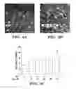 Fig. 08 - USE OF CHELATORS OF DIVALENT CATIONS TO PROMOTE NERVE REGENERATION