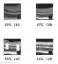 Fig. 22 - USE OF CHELATORS OF DIVALENT CATIONS TO PROMOTE NERVE REGENERATION