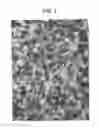 Fig. 02 - Local application of D-lactic acid dimer is selectively cytotoxic when applied to cancer cells