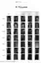 Fig. 07 - Pharmaceutical composition for preventing or treating inflammatory diseases, containing as active ingredient