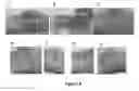 Fig. 04 - MULTIFUNCTIONAL COMPOSITE SKIN OR WOUND DRESSING AS REGENERATIVE SKIN SUBSTITUTE