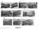 Fig. 05 - MULTIFUNCTIONAL COMPOSITE SKIN OR WOUND DRESSING AS REGENERATIVE SKIN SUBSTITUTE