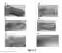 Fig. 06 - MULTIFUNCTIONAL COMPOSITE SKIN OR WOUND DRESSING AS REGENERATIVE SKIN SUBSTITUTE