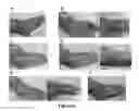 Fig. 07 - MULTIFUNCTIONAL COMPOSITE SKIN OR WOUND DRESSING AS REGENERATIVE SKIN SUBSTITUTE