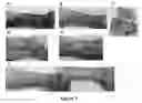 Fig. 08 - MULTIFUNCTIONAL COMPOSITE SKIN OR WOUND DRESSING AS REGENERATIVE SKIN SUBSTITUTE