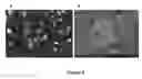 Fig. 10 - MULTIFUNCTIONAL COMPOSITE SKIN OR WOUND DRESSING AS REGENERATIVE SKIN SUBSTITUTE