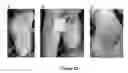 Fig. 13 - MULTIFUNCTIONAL COMPOSITE SKIN OR WOUND DRESSING AS REGENERATIVE SKIN SUBSTITUTE