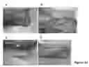 Fig. 15 - MULTIFUNCTIONAL COMPOSITE SKIN OR WOUND DRESSING AS REGENERATIVE SKIN SUBSTITUTE