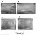 Fig. 17 - MULTIFUNCTIONAL COMPOSITE SKIN OR WOUND DRESSING AS REGENERATIVE SKIN SUBSTITUTE