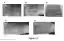 Fig. 18 - MULTIFUNCTIONAL COMPOSITE SKIN OR WOUND DRESSING AS REGENERATIVE SKIN SUBSTITUTE
